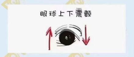 什么是眼球震顫？