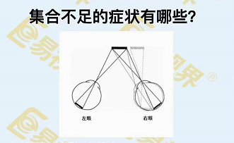 集合不足的癥狀有哪些？